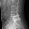 3º Curso de Quiropraxia y Master de Lesiones traumáticas. - Imagen 5
